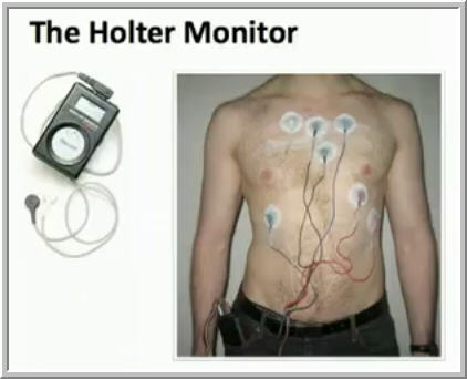 health holtermonitor